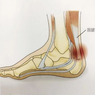 跟腱炎足球(跟腱炎对打球的影响)