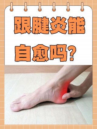 跟腱炎足球(跟腱炎对打球的影响)