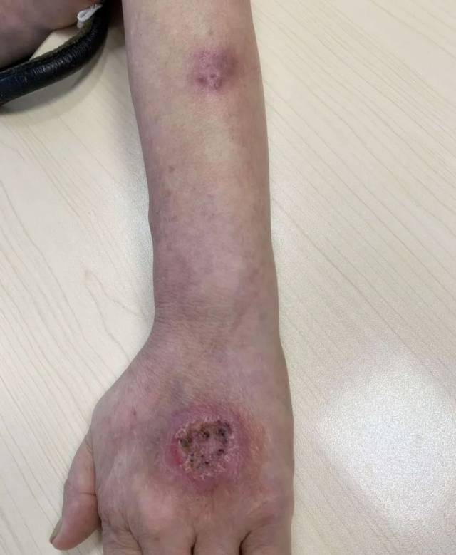 足球网有多少窟窿眼儿的简单介绍 第2张 足球网有多少窟窿眼儿的简单介绍 第2张